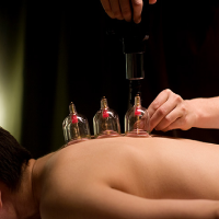 Cupping therapy in krpuram